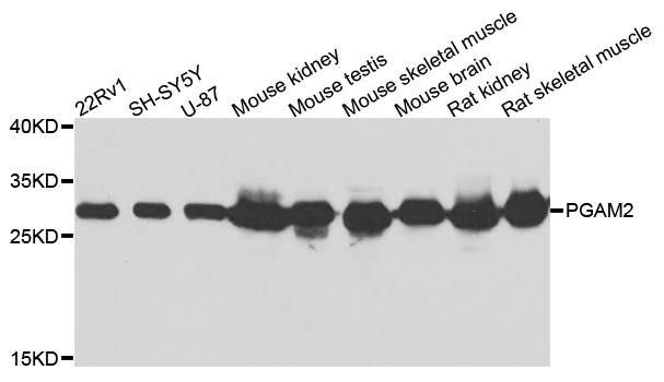 PGAM2 Antibody - Western blot analysis of extracts of various cells.