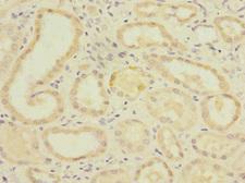 PGAM2 Antibody - Immunohistochemistry of paraffin-embedded human kidney tissue at dilution 1:100