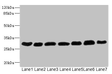 PGAM2 Antibody - Western blot All Lanes: PGAM2 antibody at 7.28ug/ml Lane 1: Rat heart tissue Lane 2: Mouse skeletal muscle tissue Lane 3: Hela whole cell lysate Lane 4: HepG-2 whole cell lysate Lane 5: Jurkat whole cell lysate Lane 6: MCF7 whole cell lysate Lane 7: U87 whole cell lysate Secondary Goat polyclonal to rabbit IgG at 1/10000 dilution Predicted band size: 29 kDa Observed band size: 29 kDa