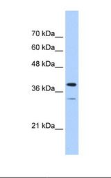 PGAM2 Antibody - Jurkat cell lysate. Antibody concentration: 1.0 ug/ml. Gel concentration: 12%.  This image was taken for the unconjugated form of this product. Other forms have not been tested.