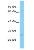 PGAM4 Antibody - PGAM4 antibody Western Blot of 293T. Antibody dilution: 1 ug/ml.  This image was taken for the unconjugated form of this product. Other forms have not been tested.