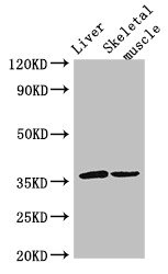 PGAM5 Antibody - Western Blot Positive WB detected in: Mouse liver tissue, Mouse skeletal muscle tissue All lanes: LYVE1 antibody at 3µg/ml Secondary Goat polyclonal to rabbit IgG at 1/50000 dilution Predicted band size: 36 kDa Observed band size: 36 kDa