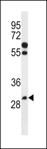 PGAP3 / PERLD1 Antibody - PGAP3 Antibody western blot of NCI-H460 cell line lysates (35 ug/lane). The PGAP3 antibody detected the PGAP3 protein (arrow).