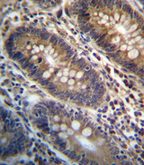 PGAP3 / PERLD1 Antibody - PGAP3 Antibody immunohistochemistry of formalin-fixed and paraffin-embedded human colon tissue followed by peroxidase-conjugated secondary antibody and DAB staining.