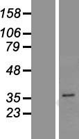 PGAP3 / PERLD1 Protein - Western validation with an anti-DDK antibody * L: Control HEK293 lysate R: Over-expression lysate