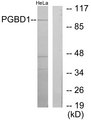 PGBD1 Antibody - Western blot analysis of lysates from HeLa cells, using PGBD1 Antibody. The lane on the right is blocked with the synthesized peptide.