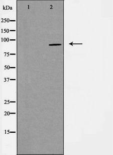 PGBD1 Antibody - Western blot analysis of extracts of HeLa cells using PGBD1 antibody. The lane on the left is treated with the antigen-specific peptide.