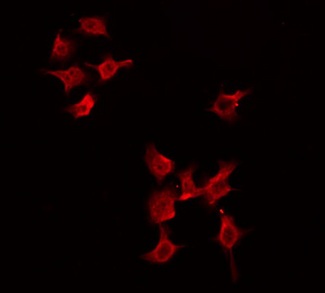 PGBD1 Antibody - Staining HeLa cells by IF/ICC. The samples were fixed with PFA and permeabilized in 0.1% Triton X-100, then blocked in 10% serum for 45 min at 25°C. The primary antibody was diluted at 1:200 and incubated with the sample for 1 hour at 37°C. An Alexa Fluor 594 conjugated goat anti-rabbit IgG (H+L) Ab, diluted at 1/600, was used as the secondary antibody.