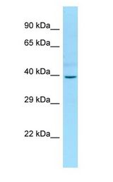 PGBD2 Antibody - PGBD2 antibody Western Blot of Fetal Small Intestine.  This image was taken for the unconjugated form of this product. Other forms have not been tested.