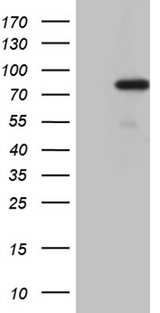 PGBD3 Antibody - HEK293T cells were transfected with the pCMV6-ENTRY control. (Left lane) or pCMV6-ENTRY PGBD3. (Right lane) cDNA for 48 hrs and lysed