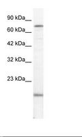 PGBD3 Antibody - Jurkat Cell Lysate.  This image was taken for the unconjugated form of this product. Other forms have not been tested.