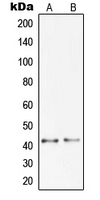 PGC / Pepsin C Antibody - Western blot analysis of Pepsinogen C expression in DU145 (A); A673 (B) whole cell lysates.