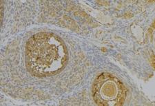 PGC / Pepsin C Antibody - 1:100 staining human uterus tissue by IHC-P. The sample was formaldehyde fixed and a heat mediated antigen retrieval step in citrate buffer was performed. The sample was then blocked and incubated with the antibody for 1.5 hours at 22°C. An HRP conjugated goat anti-rabbit antibody was used as the secondary.