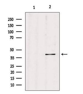 PGC / Pepsin C Antibody - Western blot analysis of extracts of c476 using PGC antibody. Lane 1 was treated with the blocking peptide.