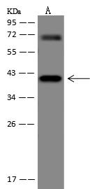 PGC / Pepsin C Antibody - Anti-PGC rabbit polyclonal antibody at 1:500 dilution. Lane A: HepG2 Whole Cell Lysate. Lysates/proteins at 30 ug per lane. Secondary: Goat Anti-Rabbit IgG (H+L)/HRP at 1/10000 dilution. Developed using the ECL technique. Performed under reducing conditions. Predicted band size: 42 kDa. Observed band size: 42 kDa. (We are unsure as to the identity of these extra bands.)