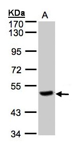 PGCP / Aminopeptidase Antibody - Sample (30 ug of whole cell lysate). A: Raji. 7.5% SDS PAGE. PGCP / Aminopeptidase antibody diluted at 1:500
