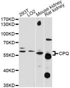 PGCP / Aminopeptidase Antibody - Western blot analysis of extracts of various cell lines, using CPQ antibody at 1:1000 dilution. The secondary antibody used was an HRP Goat Anti-Rabbit IgG (H+L) at 1:10000 dilution. Lysates were loaded 25ug per lane and 3% nonfat dry milk in TBST was used for blocking. An ECL Kit was used for detection and the exposure time was 90s.