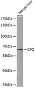 PGCP / Aminopeptidase Antibody - Western blot analysis of extracts of mouse liver using CPQ Polyclonal Antibody at dilution of 1:1000.