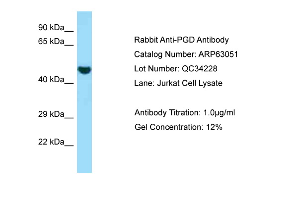 PGD Antibody -  This image was taken for the unconjugated form of this product. Other forms have not been tested.