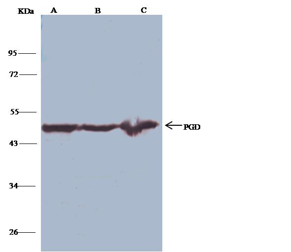PGD Antibody - PGD was immunoprecipitated using: Lane A: 0.5 mg Raji Whole Cell Lysate. Lane B: 0.5 mg MOLT-4 Whole Cell Lysate. Lane C:0.5 mg A549 Whole Cell Lysate. 4 uL anti-PGD rabbit polyclonal antibody and 15 ul of 50% Protein G agarose. Primary antibody: Anti-PGD rabbit polyclonal antibody, at 1:100 dilution. Secondary antibody: Clean-Blot IP Detection Reagent (HRP) at 1:1000 dilution. Developed using the DAB staining technique. Performed under reducing conditions. Predicted band size: 53 kDa. Observed band size: 53 kDa.