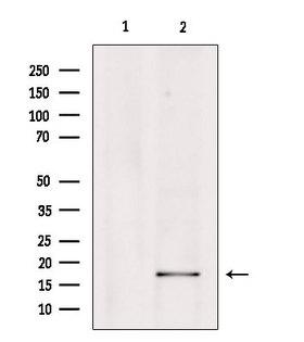 PGES / PTGES Antibody - Western blot analysis of extracts of HepG2 cells using PGE synthase antibody. Lane 1 was treated with the blocking peptide.