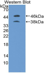 PGF / PLGF Antibody - Western Blot; Sample: Recombinant protein.