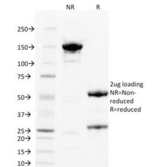 PGF / PLGF Antibody - SDS-PAGE Analysis of Purified, BSA-Free PLGF Antibody (clone PLGF/93). Confirmation of Integrity and Purity of the Antibody.
