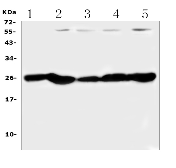 PGF / PLGF Antibody - Western blot analysis of PGF using anti-PGF antibody. Electrophoresis was performed on a 5-20% SDS-PAGE gel at 70V (Stacking gel) / 90V (Resolving gel) for 2-3 hours. The sample well of each lane was loaded with 50ug of sample under reducing conditions. Lane 1: rat gaster tissue lysates, Lane 2: rat liver tissue lysates,Lane 3: mouse gaster tissue lysates,Lane 4: mouse liver tissue lysates,Lane 5: mouse HEPA1-6 whole cell lysates. After Electrophoresis, proteins were transferred to a Nitrocellulose membrane at 150mA for 50-90 minutes. Blocked the membrane with 5% Non-fat Milk/ TBS for 1.5 hour at RT. The membrane was incubated with rabbit anti-PGF antigen affinity purified polyclonal antibody at 0.5 ug/mL overnight at 4?, then washed with TBS-0.1% Tween 3 times with 5 minutes each and probed with a goat anti-rabbit IgG-HRP secondary antibody at a dilution of 1:10000 for 1.5 hour at RT. The signal is developed using an Enhanced Chemiluminescent detection (ECL) kit with Tanon 5200 system. A specific band was detected for PGF at approximately 25KD. The expected band size for PGF is at 25KD.