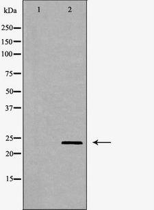 PGF / PLGF Antibody - Western blot analysis of HepG2 whole cells lysates using PGF antibody. The lane on the left is treated with the antigen-specific peptide.