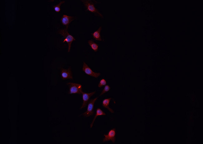 PGF / PLGF Antibody - Staining HepG2 cells by IF/ICC. The samples were fixed with PFA and permeabilized in 0.1% Triton X-100, then blocked in 10% serum for 45 min at 25°C. The primary antibody was diluted at 1:200 and incubated with the sample for 1 hour at 37°C. An Alexa Fluor 594 conjugated goat anti-rabbit IgG (H+L) antibody, diluted at 1/600, was used as secondary antibody.