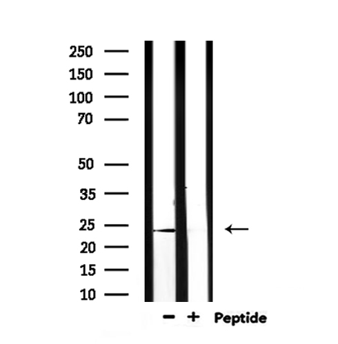 PGF / PLGF Antibody - Western blot analysis of extracts of rat muscle using PGF antibody.