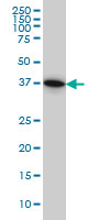 PGGT1B Antibody - PGGT1B monoclonal antibody (M02), clone 5E4 Western blot of PGGT1B expression in HeLa.
