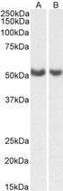 PGIS / PTGIS Antibody - Goat anti-PTGIS / CYP8A1 (aa248-258) Antibody (0.5µg/ml) staining of Human Lung (A) and Ovary (B) lysates (35µg protein in RIPA buffer). Primary incubation was 1 hour. Detected by chemiluminescencence.
