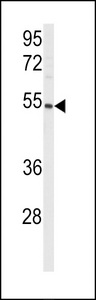 PGIS / PTGIS Antibody - Western blot of anti-CYP8A1 Antibody in mouse lung tissue lysates (35 ug/lane). CYP8A1(arrow) was detected using the purified antibody.