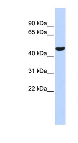 PGIS / PTGIS Antibody - PTGIS antibody Western blot of Fetal Brain lysate. This image was taken for the unconjugated form of this product. Other forms have not been tested.