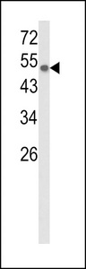 PGIS / PTGIS Antibody - Western blot of CYP8A1 Antibody in CEM cell line lysates (35 ug/lane). CYP8A1 (arrow) was detected using the purified antibody.