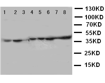 PGK1 / Phosphoglycerate Kinase Antibody - WB of PGK1/Phosphoglycerate Kinase 1 antibody. Lane 1: Rat Liver Tissue Lysate. Lane 2: Rat Brain Tissue Lysate. Lane 3: Rat Lung Tissue Lysate. Lane 4: A431 Cell Lysate. Lane 5: COLO320 Cell Lysate. Lane 6: HELA Cell Lysate. Lane 7: A549 Cell Lysate. Lane 8: JURKAT Cell Lysate..