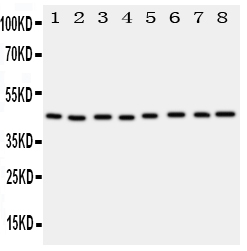 PGK1 / Phosphoglycerate Kinase Antibody - Anti-PGK1 antibody, Western blotting Lane 1: Rat Liver Tissue LysateLane 2: Rat Brain Tissue LysateLane 3: Rat Lung Tissue LysateLane 4: A431 Cell LysateLane 5: COLO320 Cell LysateLane 6: HELA Cell LysateLane 7: A549 Cell Lysate Lane 8: JURKAT Cell Lysate