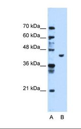 PGK1 / Phosphoglycerate Kinase Antibody - Lane A: Marker. Lane B: HepG2 cell lysate. Antibody concentration: 1.25 ug/ml. Gel concentration: 12%.  This image was taken for the unconjugated form of this product. Other forms have not been tested.