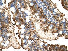 PGK1 / Phosphoglycerate Kinase Antibody - PGK1 antibody PGK1(phosphoglycerate kinase 1) Antibody was used in IHC to stain formalin-fixed, paraffin-embedded human intestine.  This image was taken for the unconjugated form of this product. Other forms have not been tested.