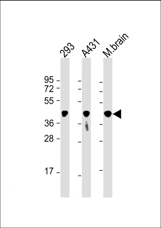 PGK1 / Phosphoglycerate Kinase Antibody - All lanes: Anti-PGK1 Antibody at 1:8000 dilution Lane 1: 293 whole cell lysate Lane 2: A431 whole cell lysate Lane 3: mouse brain lysate Lysates/proteins at 20 µg per lane. Secondary Goat Anti-mouse IgG, (H+L), Peroxidase conjugated at 1/10000 dilution. Predicted band size: 45 kDa Blocking/Dilution buffer: 5% NFDM/TBST.