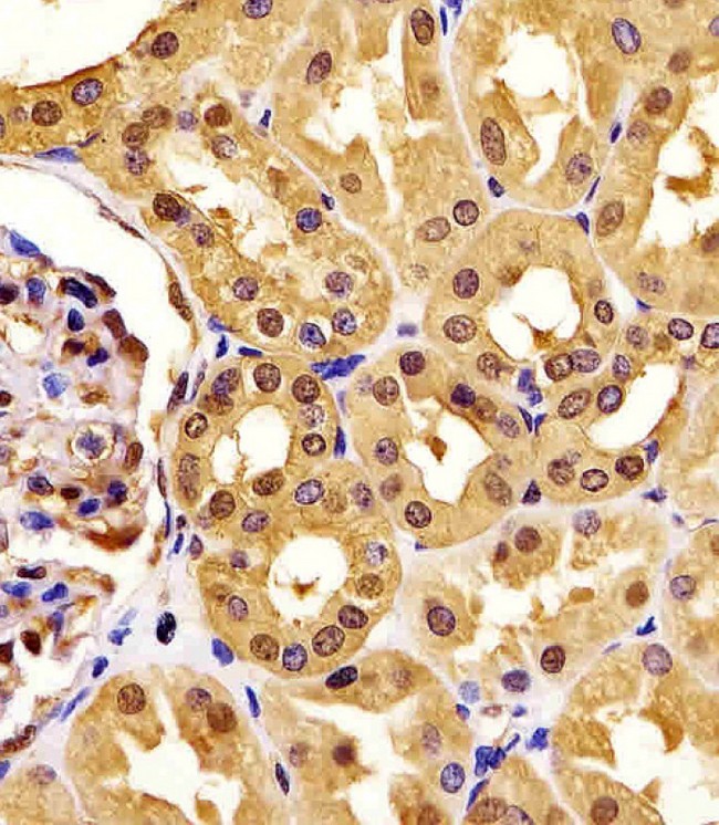 PGK1 / Phosphoglycerate Kinase Antibody - PGK1 Antibody staining PGK1 in human kidney tissue sections by Immunohistochemistry (IHC-P - paraformaldehyde-fixed, paraffin-embedded sections). Tissue was fixed with formaldehyde and blocked with 3% BSA for 0. 5 hour at room temperature; antigen retrieval was by heat mediation with a citrate buffer (pH6). Samples were incubated with primary antibody (1/25) for 1 hours at 37°C. A undiluted biotinylated goat polyvalent antibody was used as the secondary antibody.