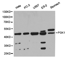 PGK1 / Phosphoglycerate Kinase Antibody - Western blot of extracts of various cell lines, using PGK1 antibody.