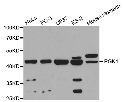 PGK1 / Phosphoglycerate Kinase Antibody - Western blot analysis of extracts of various cell lines.