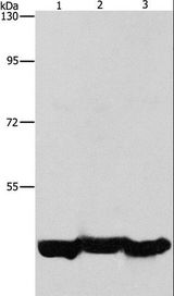 PGK1 / Phosphoglycerate Kinase Antibody - Western blot analysis of A549 cell and mouse liver tissue, hepG2 cell, using PGK1 Polyclonal Antibody at dilution of 1:1000.