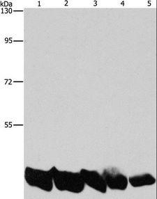 PGK1 / Phosphoglycerate Kinase Antibody - Western blot analysis of A549 and HeLa cell, mouse liver and human liver tissue, hepG2 cell, using PGK1 Polyclonal Antibody at dilution of 1:850.