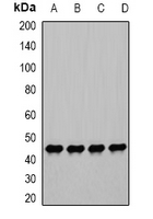 PGK1 / Phosphoglycerate Kinase Antibody - Western blot analysis of PGK1 expression in HeLa (A); PC3 (B); ES2 (C); mouse stomach (D) whole cell lysates.