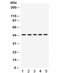 PGK1 / Phosphoglycerate Kinase Antibody
