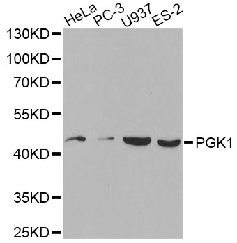 PGK1 / Phosphoglycerate Kinase Antibody - Western blot analysis of extracts of various cell lines, using PGK1 antibody at 1:1000 dilution. The secondary antibody used was an HRP Goat Anti-Rabbit IgG (H+L) at 1:10000 dilution. Lysates were loaded 25ug per lane and 3% nonfat dry milk in TBST was used for blocking.