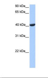 PGK2 Antibody - Placenta lysate. Antibody concentration: 1.0 ug/ml. Gel concentration: 12%.  This image was taken for the unconjugated form of this product. Other forms have not been tested.